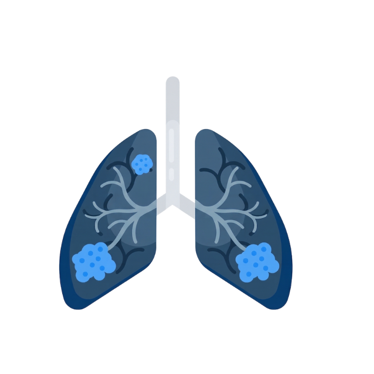 Lung cancer diagnosis and treatment